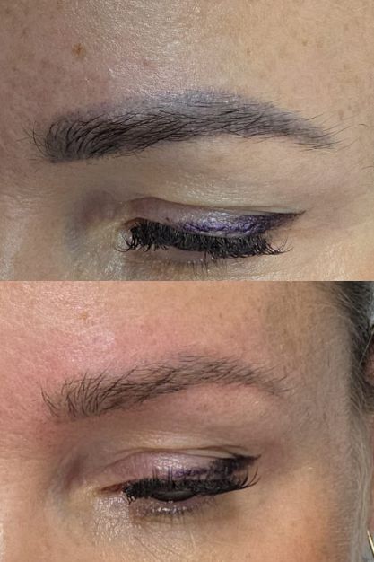 def (1) PMU Verwijderen