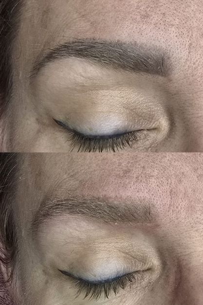 def (4) PMU Verwijderen