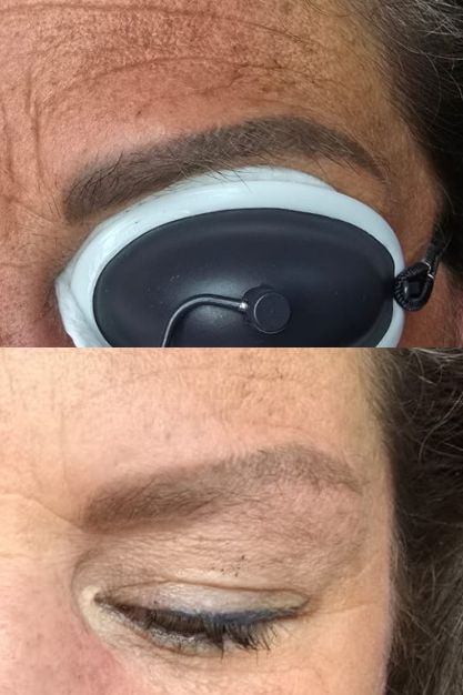 PMU Verwijderen PMU Verwijderen